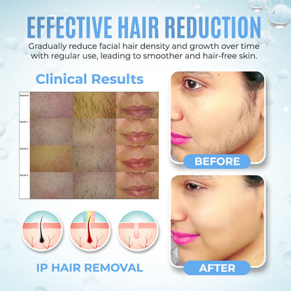 PCOS Facial Hair Natural Treatment At Home 💡